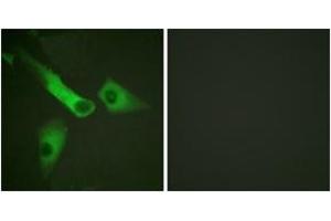Immunofluorescence analysis of HepG2 cells, using Caspase 9 (Phospho-Tyr153) Antibody.