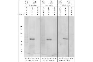Effect of denaturing temperature on Western blot on brain lysates using Rabbit antibody to ChAT (70-120): . (Choline Acetyltransferase anticorps)