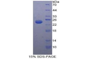SDS-PAGE analysis of Human cPLA2 Protein. (PLA2G4A Protéine)