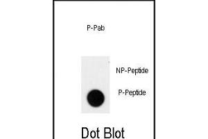 Dot blot analysis of anti-Phospho-ACK1-p Phospho-specific Pab (ABIN650839 and ABIN2839804) on nitrocellulose membrane. (TNK2 anticorps  (pTyr826))
