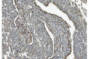 IHC analysis of Caspase-9/CASP9 using anti-Caspase-9/CASP9 antibody (ABIN7601196).