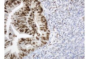 Image no. 7 for anti-Proliferating Cell Nuclear Antigen (PCNA) antibody (ABIN1500061) (PCNA anticorps)