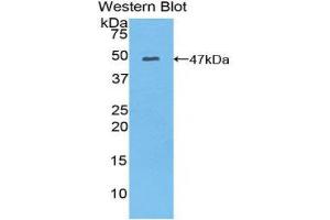 Western Blotting (WB) image for anti-Myosin, Light Chain 6B, Alkali, Smooth Muscle and Non-Muscle (MYL6B) (AA 6-137) antibody (ABIN1859943) (MYL6B anticorps  (AA 6-137))