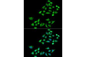 Immunofluorescence analysis of A549 cells using KLK4 antibody (ABIN5973996). (Kallikrein 4 anticorps)