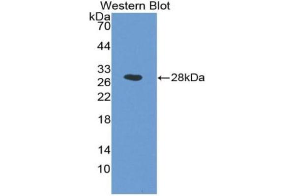ICAM2 anticorps  (AA 29-247)