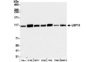 anti-Ubiquitin Specific Peptidase 15 (USP15) (C-Term) antibody