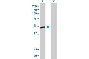 Western Blot analysis of C17orf75 expression in transfected 293T cell line by C17orf75 MaxPab polyclonal antibody. (C17orf75 anticorps  (AA 1-396))