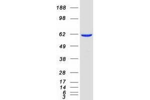 Validation with Western Blot