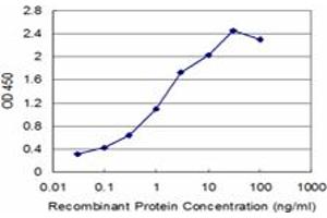 Detection limit for recombinant GST tagged SETDB1 is approximately 0.