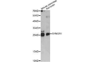 Western blot analysis of extracts of various cell lines, using SYNGR1 antibody (ABIN6290976) at 1:1000 dilution. (Synaptogyrin 1 anticorps)