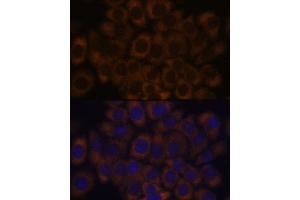 Immunofluorescence analysis of HeLa cells using RPL23A antibody (ABIN1682576, ABIN3018519, ABIN3018520 and ABIN6220494) at dilution of 1:100.