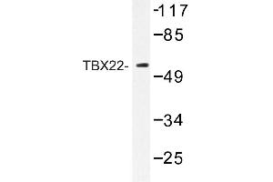 Image no. 1 for anti-T-Box 22 (TBX22) antibody (ABIN272263) (T-Box 22 anticorps)