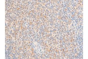 ABIN6267236 at 1/100 staining mouse spleen tissue sections by IHC-P.