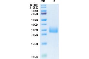 Mouse CD161 on Tris-Bis PAGE under reduced condition. (CD161 Protein (AA 67-227) (His tag))