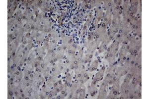 Image no. 2 for anti-TIA1 Cytotoxic Granule-Associated RNA Binding Protein (TIA1) antibody (ABIN1501387) (TIA1 anticorps)