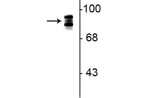Western blot of rat lung lysate showing specific immunolabeling of the ~93 kDa periostin protein triplet.