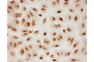 ICC testing of PIAS1 antibody and A549 cells