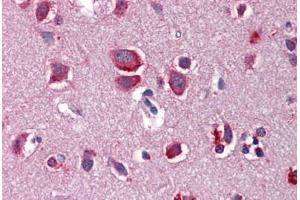 Human Brain, Cortex: Formalin-Fixed, Paraffin-Embedded (FFPE)