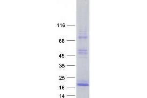 Validation with Western Blot