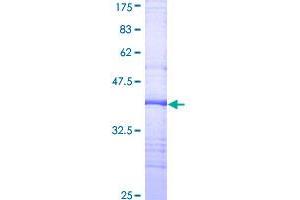 Image no. 1 for Fc Fragment of IgG, Low Affinity IIb, Receptor (CD32) (FCGR2B) (AA 45-154) protein (GST tag) (ABIN1353899)