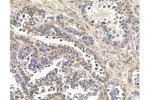 anti-Coenzyme Q10 Homolog B (COQ10B) antibody