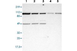Western blot analysis of Lane 1: RT-4, Lane 2: EFO-21, Lane 3: A-431, Lane 4: Liver, Lane 5: Tonsil with ASCC2 polyclonal antibody  at 1:250-1:500 dilution. (ASCC2 anticorps)
