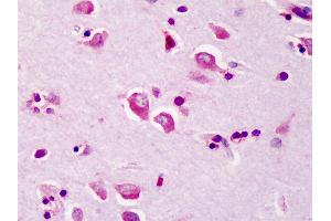 anti-TNF Receptor-Associated Factor 3 (TRAF3) (C-Term) antibody
