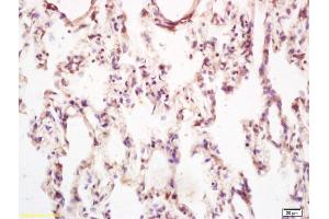 Formalin-fixed and paraffin embedded rat lung tissue labeled with Anti-PPIG Polyclonal Antibody, Unconjugated (ABIN700450) at 1:200, followed by conjugation to the secondary antibody and DAB staining (PPIG anticorps  (AA 351-450))