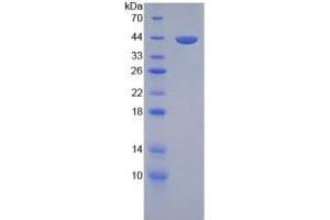 SDS-PAGE of Protein Standard from the Kit (Highly purified E. (Transferrin Kit ELISA)