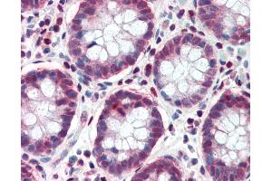 Anti-TCF7L1 antibody IHC of human colon.