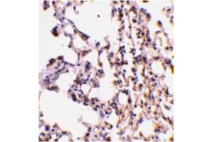 Immunohistochemistry (IHC) image for anti-BH3 Interacting Domain Death Agonist (BID) (C-Term) antibody (ABIN1030296) (BID anticorps  (C-Term))