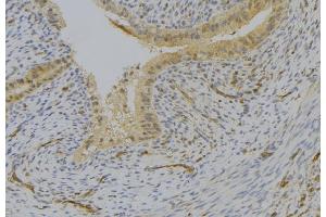 ABIN6276932 at 1/100 staining Human uterus tissue by IHC-P. (LY96 anticorps  (Internal Region))