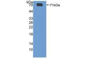 Detection of Recombinant SGSH, Human using Polyclonal Antibody to N-Sulfoglucosamine Sulfohydrolase (SGSH)