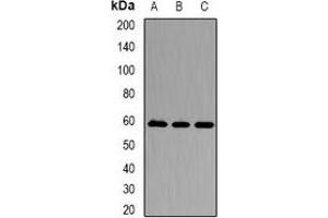 Western blot analysis of Karyopherin alpha-3 expression in Jurkat (A), A549 (B), Hela (C) whole cell lysates. (KPNA3 anticorps)
