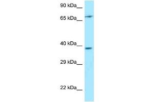 Western Blotting (WB) image for anti-Thymocyte Selection Associated (THEMIS) (C-Term) antibody (ABIN2789620) (THEMIS anticorps  (C-Term))