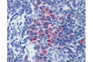 Anti-CD11b antibody IHC of mouse spleen. (CD11b anticorps)