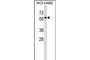 TYRP1 Antibody (Center) (ABIN1538332 and ABIN2849139) western blot analysis in NCI- cell line lysates (35 μg/lane). (Tyrosinase-Related Protein 1 anticorps  (AA 341-371))