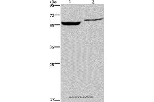 Western blot analysis of Raji and 293T cell, using IMPDH1 Polyclonal Antibody at dilution of 1:500 (IMPDH1 anticorps)