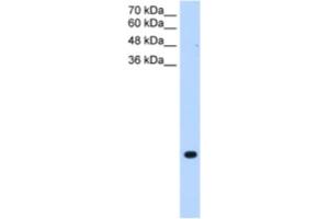 Western Blotting (WB) image for anti-Transmembrane Protein 75 (TMEM75) antibody (ABIN2463990) (TMEM75 anticorps)