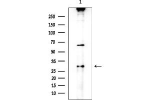 Western blot analysis of lysates from COLO205 cells, using FCGR2C Antibody at 1/1000 dilution.