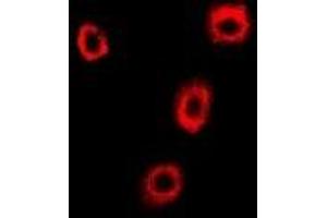 anti-Coatomer Protein Complex, Subunit beta 2 (COPB2) antibody