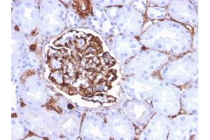 Formalin-fixed, paraffin-embedded human Kidney stained with Nestin Mouse Monoclonal Antibody (NES/2911).