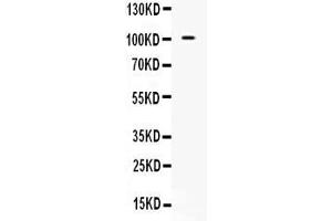 Western blot analysis of NARG1 expression in 293T whole cell lysates ( Lane 1). (NAA15 anticorps  (N-Term))