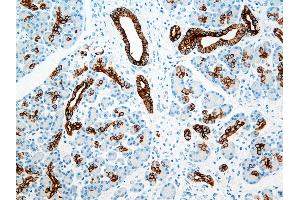 Immunohistochemistry (IHC) image for anti-Keratin 8/18/19 (KRT8/18/19) antibody (ABIN108431) (Keratin 8/18/19 anticorps)