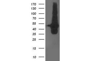 Western Blotting (WB) image for anti-DOK2 (DOK2) antibody (ABIN1497881) (DOK2 anticorps)