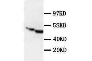 Polyclonal Anti-Glial fibrillary acidic protein GFAP Antibody (GFAP anticorps  (C-Term))