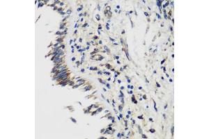 Immunohistochemistry of paraffin-embedded human lung using SMYD1 antibody (ABIN6128707, ABIN6148163, ABIN6148165 and ABIN6219496) at dilution of 1:200 (40x lens). (SMYD1 anticorps  (AA 1-350))