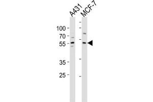 Western Blotting (WB) image for anti-Kruppel-Like Factor 4 (Gut) (KLF4) antibody (ABIN2996460) (KLF4 anticorps)