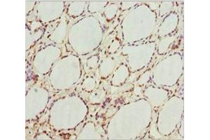 Immunohistochemistry of paraffin-embedded human thyroid tissue using ABIN7154750 at dilution of 1:100 (GNB1L anticorps  (AA 1-327))