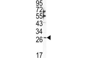 Western blot analysis of SNAI1 antibody and NCI-H460 lysate (SNAIL anticorps  (AA 1-30))